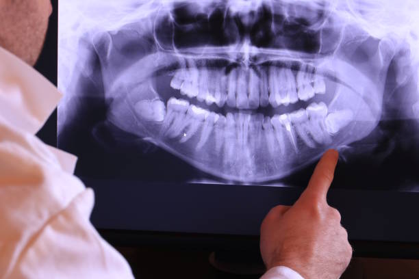 Best Emergency Root Canal Treatment in Harrisville, UT